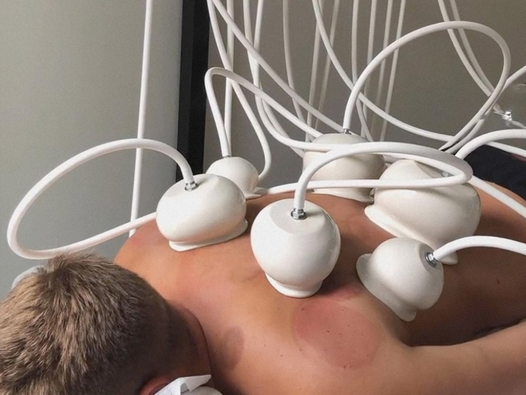 Vakuum Schröpfmassge